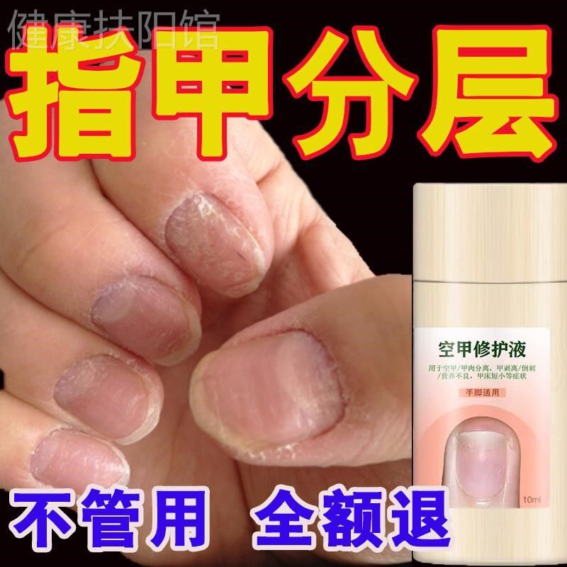 指甲增长液生长快速指甲分层凹凸不平空甲修覆受损甲床修覆增长液