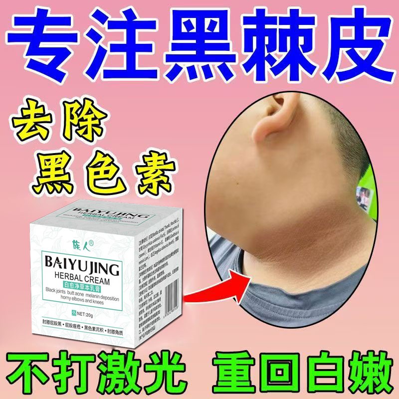 白愈腚脚踝关节黑洗不净脖子黑颈部膝盖私处黑色素沉淀腋下胳膊肘