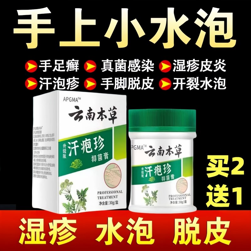云南本草汗孢疹汗泡珍疱疹膏止痒汉状真菌感染手气膏手上起小水泡