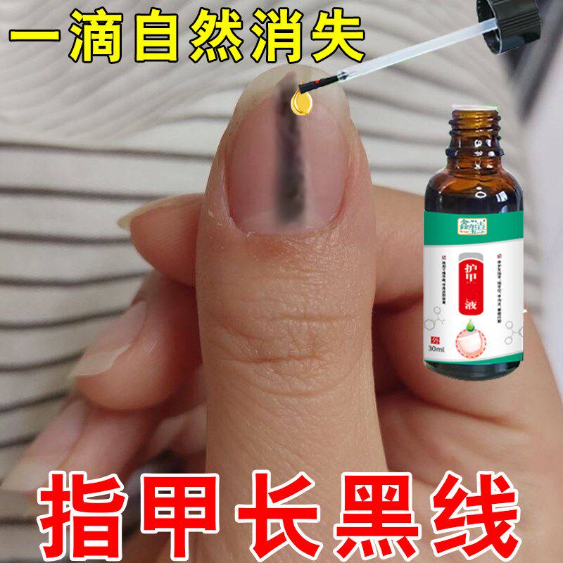 指甲长黑线治黑指甲甲母痣专用修复液手脚指甲油黑色竖纹灰/指甲W