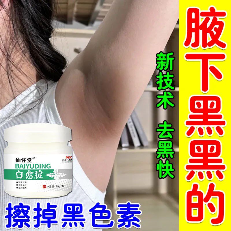屁股去黑臀部坐印药膏大腿内侧不黑了除色素脖子去黑黑棘皮症神器