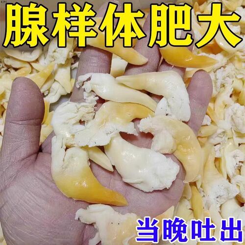 【中药调理】腺样体肥大童面容矫正器张嘴打鼾中药调理贴