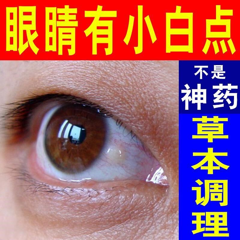 眼睛有异物感眼里有小白点磨眼干 干涩酸胀模糊看不清专用草本眼