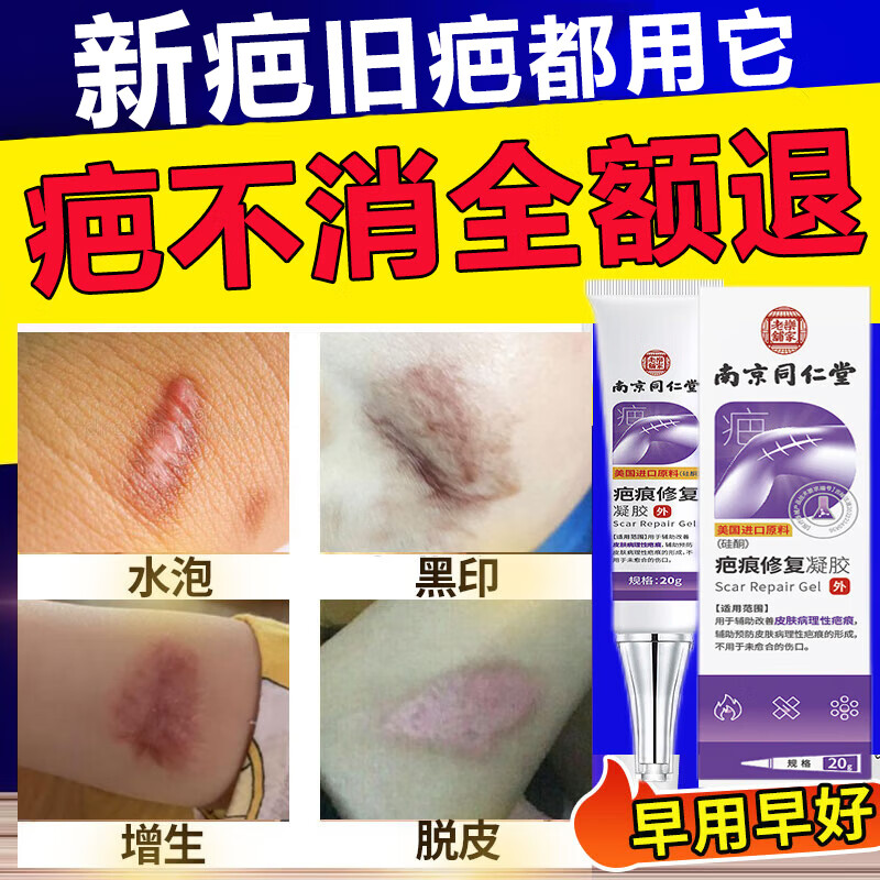 祛疤膏医用硅酮凝胶痕修复