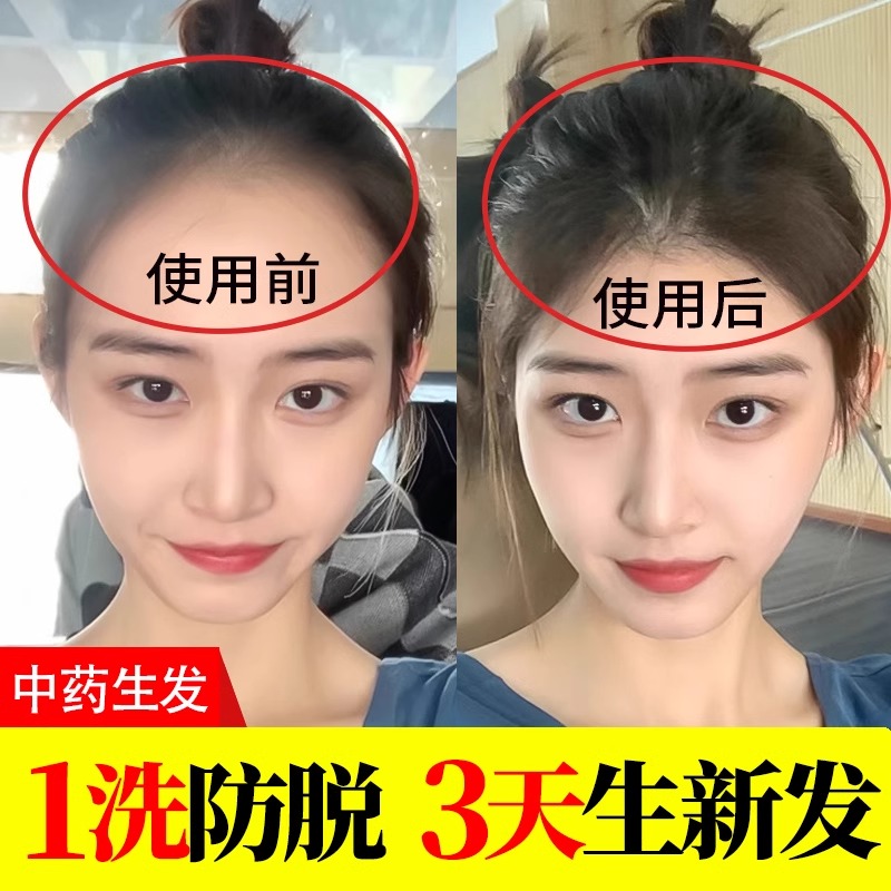 洗发水防脱发生中药增发密发侧柏叶何首乌纯植物生姜排行榜名