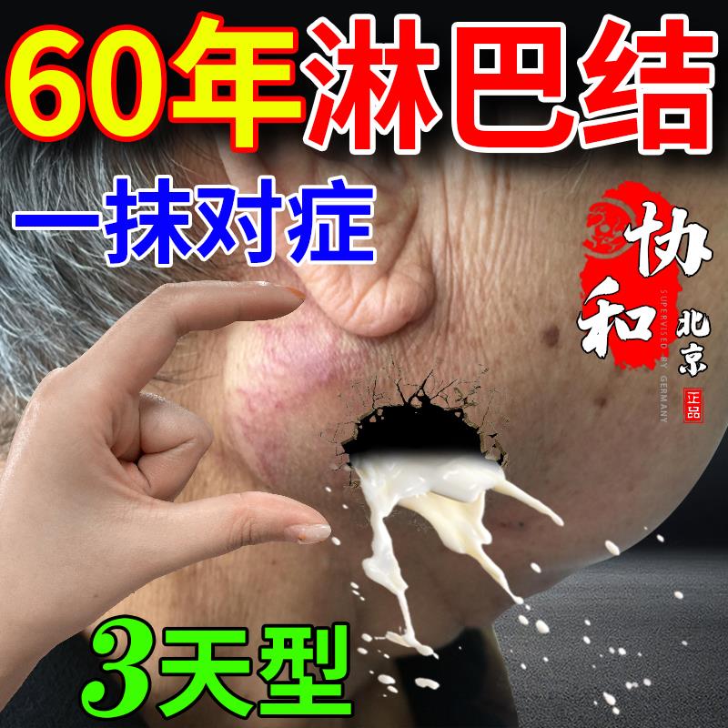 淋巴结肿大散结贴非消除脖子颈部非消散膏腋下结节副乳疏通非特效