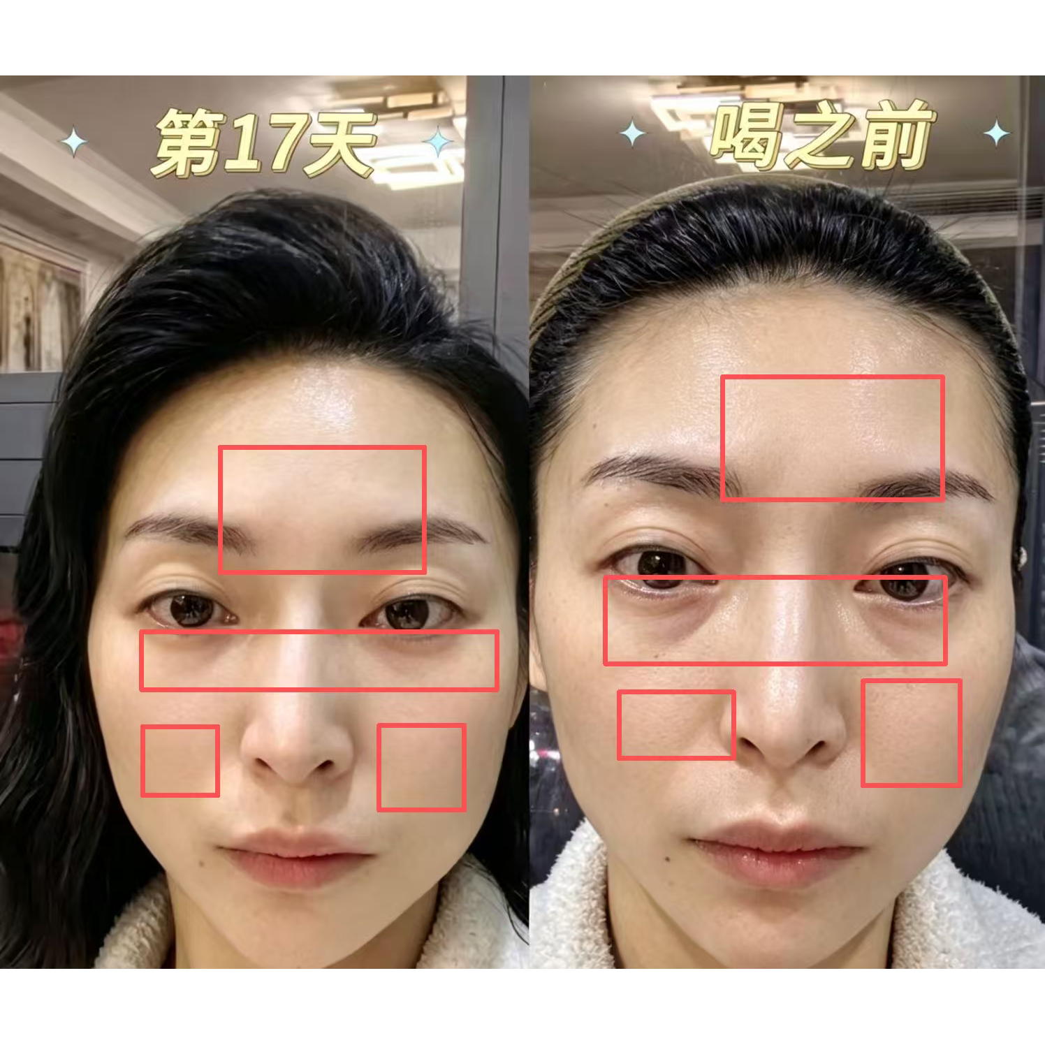 【橙子专享】口服Y美III型胶原 反馈