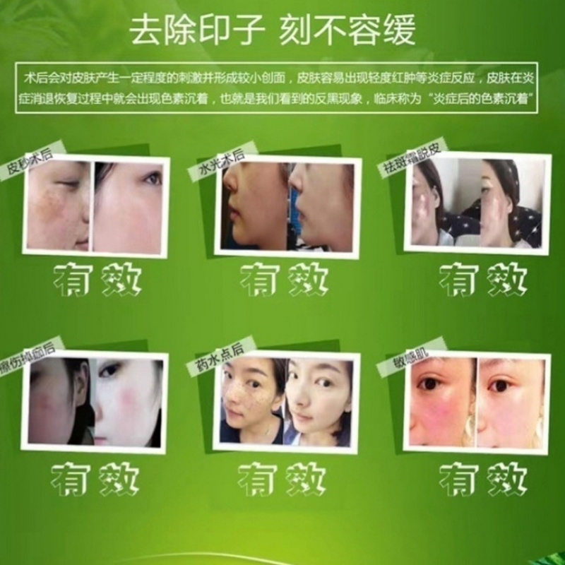 修护因子舒缓膏624031