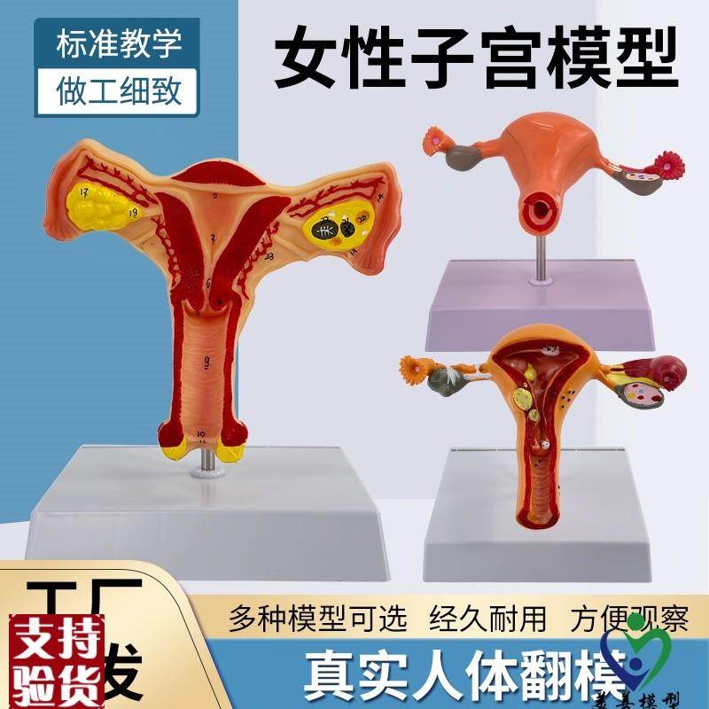 人体子宫模型女性生殖模型阴道卵巢模型教K学模具病理变化科学教