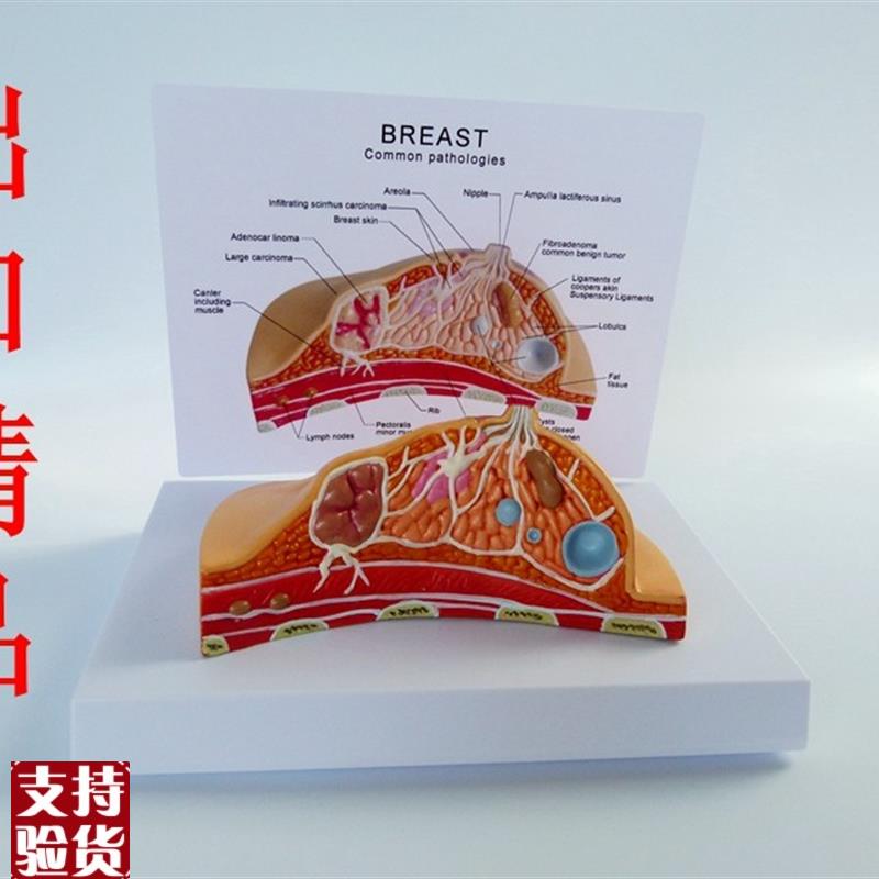 桌上型乳房模型乳腺疾病肿块癌带说明板人体模Z型医学教具