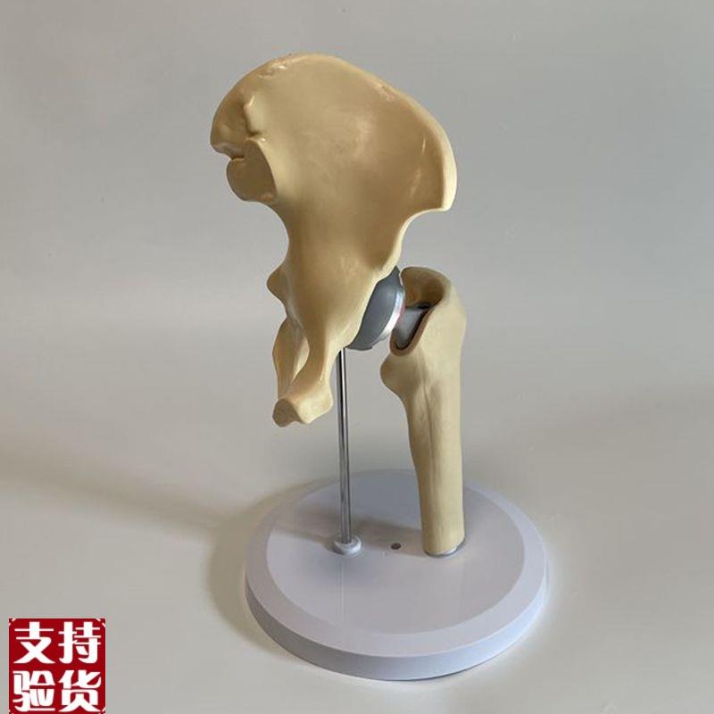 康泰教具人工髋关节置换模型假肢手术摆件医院P髋臼假关节骨骼模