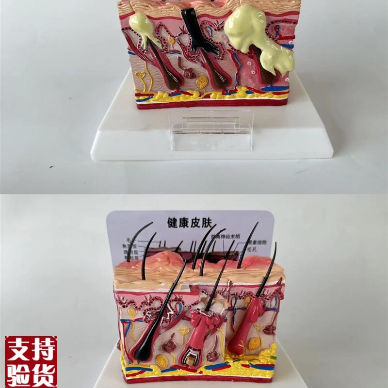 狗皮肤解剖模型痤疮表皮毛囊解剖真皮医学美容S整形立体皮肤教具