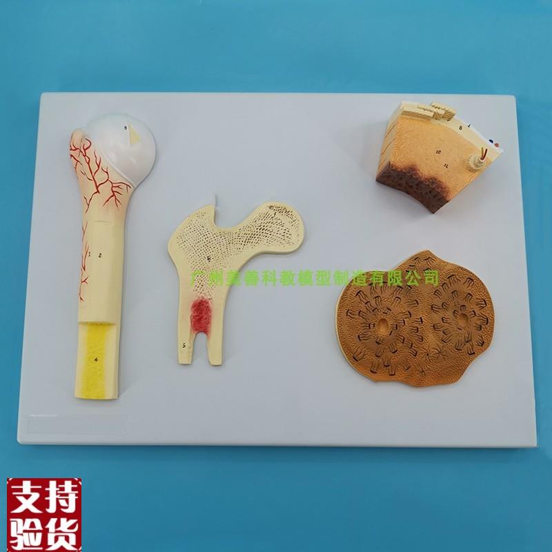 长骨结构骨的结构模型血管松质骨密质I骨股骨哈弗系统骨骼解剖