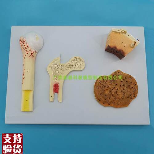 长骨结构骨的结构模型血管松质骨密质I骨股骨哈弗系统骨骼解剖