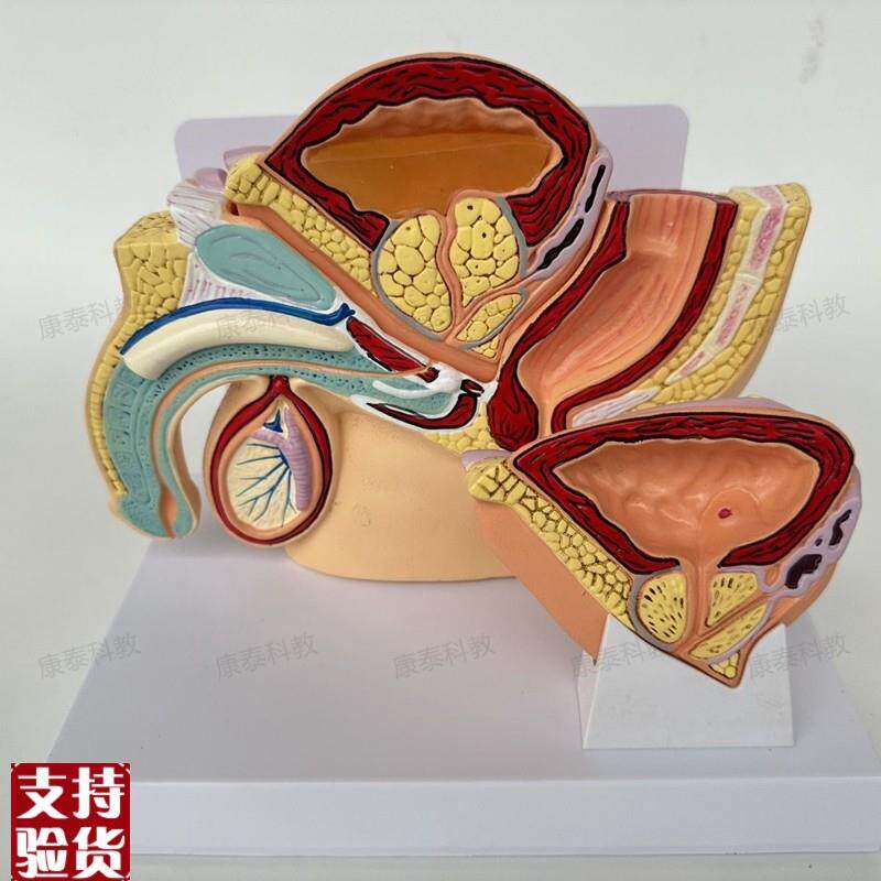 康泰医学教具男性l盆腔膀胱前列腺病理男科医药促销医患示教生殖
