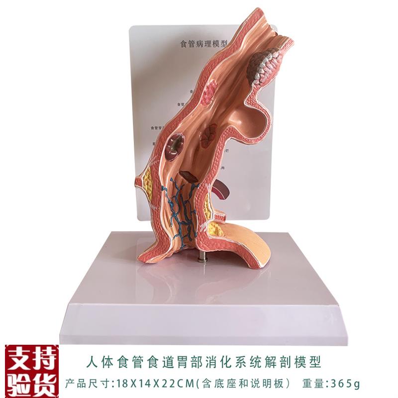 人体食管食道胃部消化系统解剖模型教学内脏解R剖人体教具厂家直