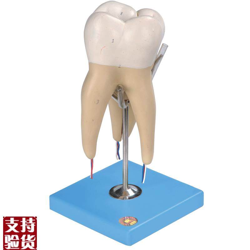 磨牙有三个牙o根模型B10004/5