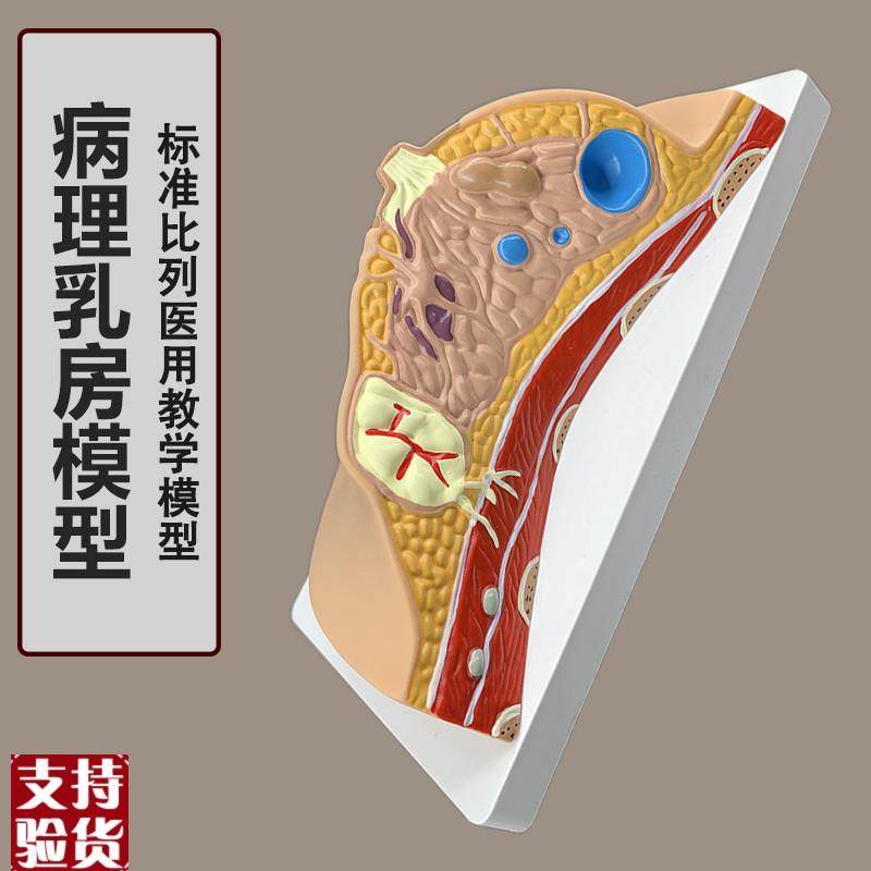 女性病理乳房模型人体1:1乳房模E型乳腺解剖女性医院教学教具