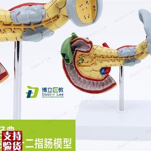 消化胰脏病变胰脾胆十二指肠模型进口模型人体病变内Y脏解剖模型