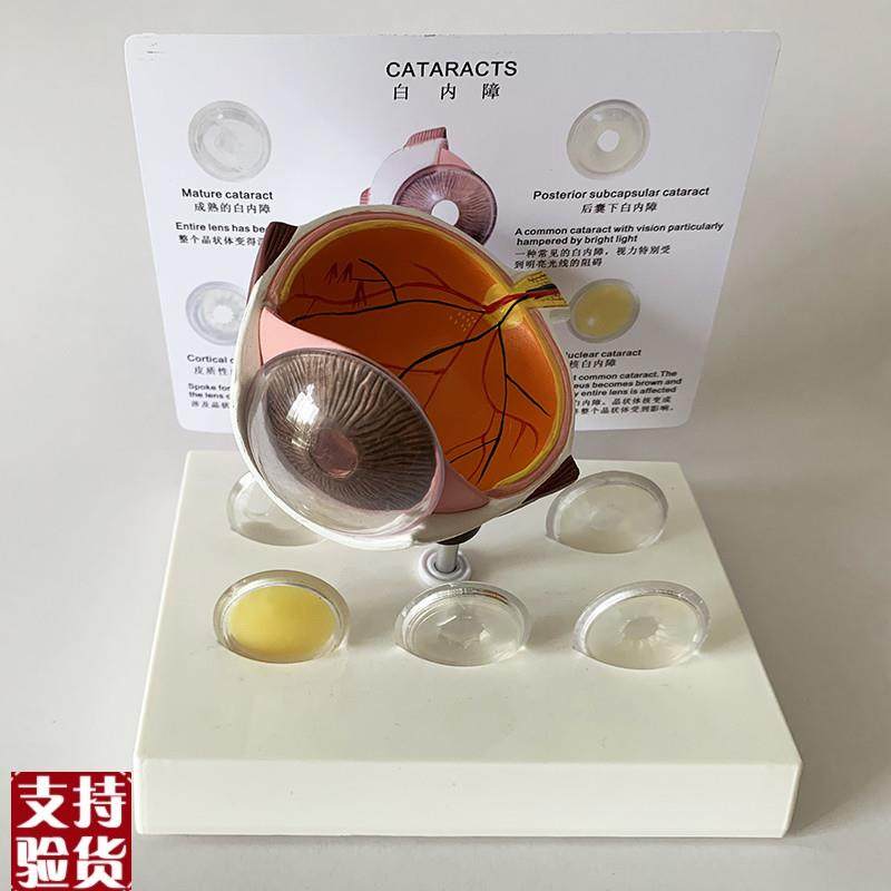 白内障眼睛模型晶片虹膜器官解A剖光学教仪医用医学教学教具包邮,文具电教/文化用品/商务用品,教学标本/模型,淘宝优惠券,粉丝福利购,淘宝优惠卷