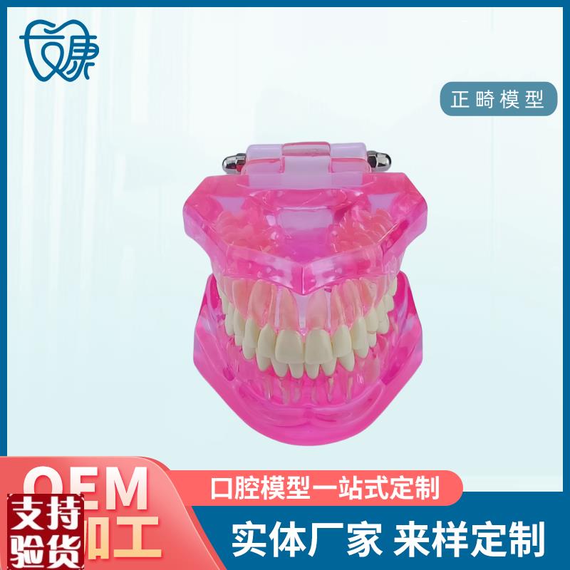 牙齿模型病理修复可拆r卸正畸口腔病理牙模型牙科医患活动沟通