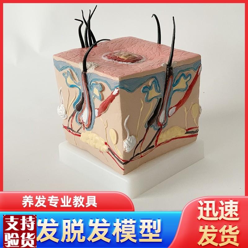 人体毛发脱发模型头发头皮t发炎毛细血管毛囊收缩教学教具演示模