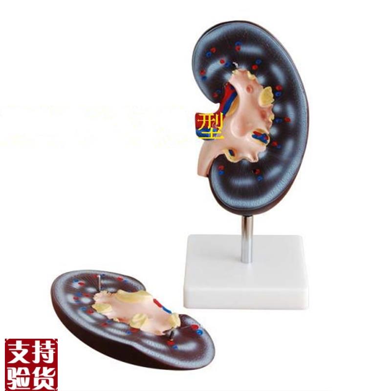 肾解剖模型2件