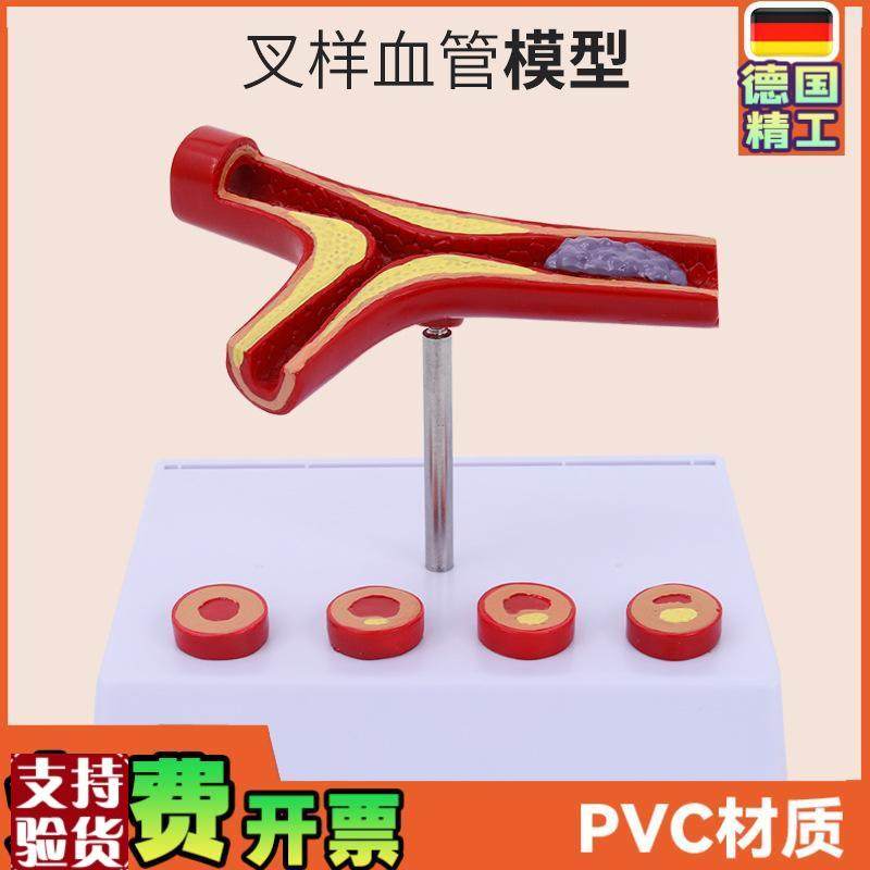 人体血管解剖模型血管模型动脉(硬)化L展示各阶段年龄层血管