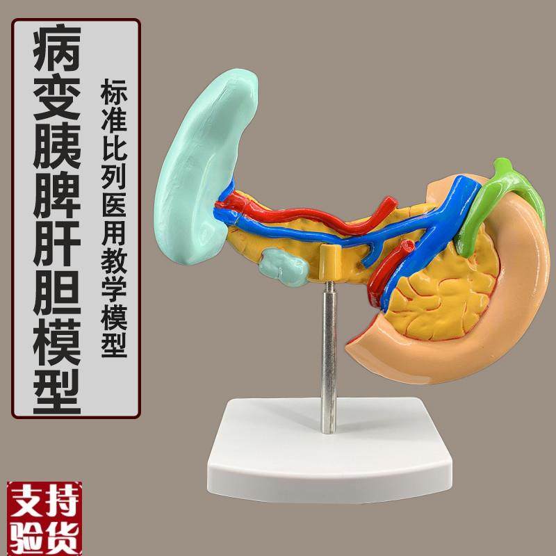 病变胰脾肝胆十二指肠模型病y理标本胰脾肝胆人体器官解剖教学模,玩具/童车/益智/积木/模型,其他模型玩具,淘宝优惠券,粉丝福利购,淘宝优惠卷