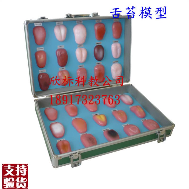 舌苔模型舌像模型30种正常舌苔及各G种疾病在舌苔上的病态变症状