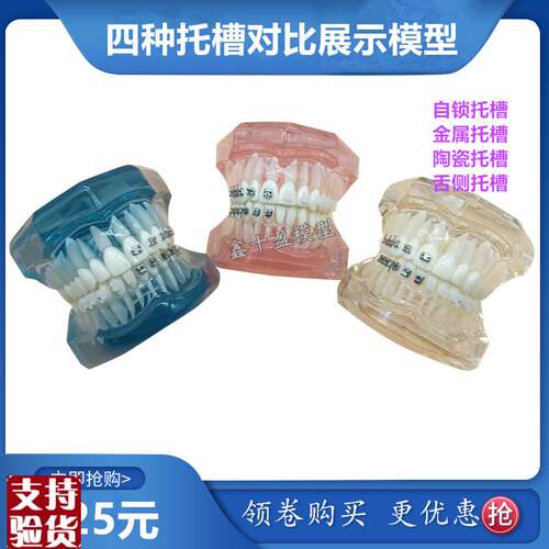 牙科正畸模型4种托槽对比模型金属陶瓷舌侧R自锁托槽示范模型