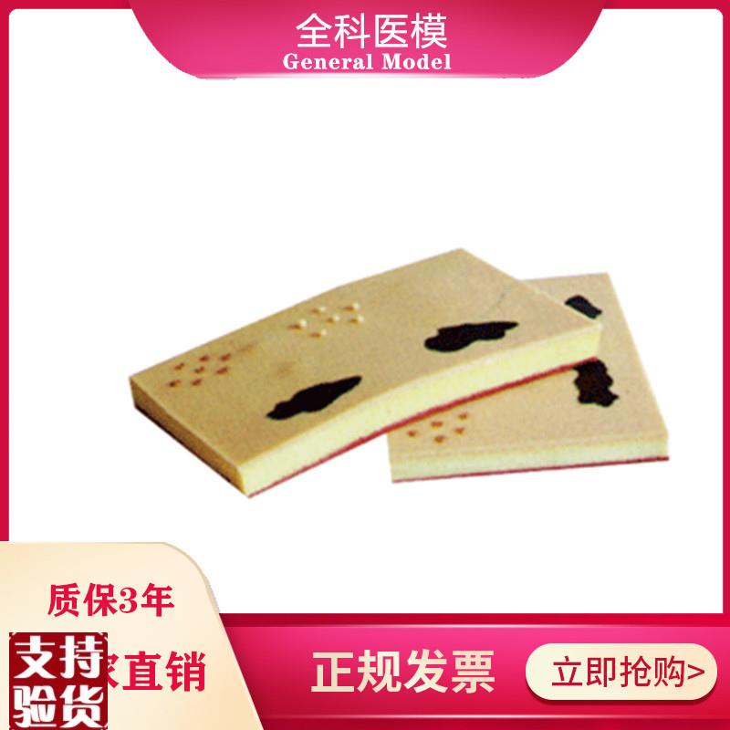 表皮常见病e表处理训练模块GM/W00103