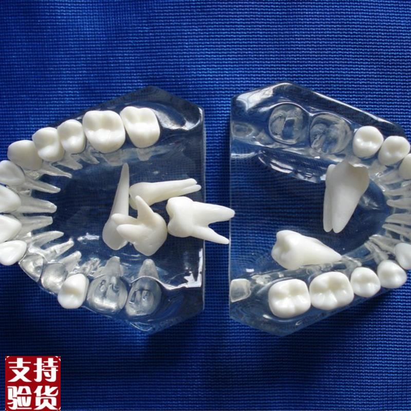 水晶透明牙模型可拆卸拔牙E练习牙齿解剖构造模型
