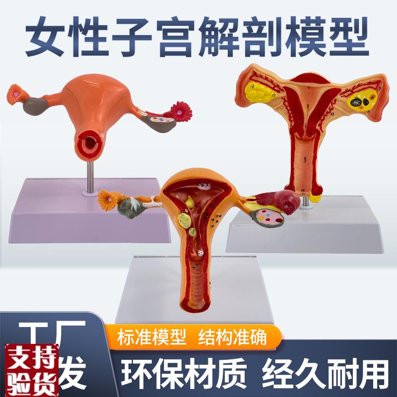 女性内生殖解剖模m型子宫卵巢模型生殖结构模型计生妇科模型