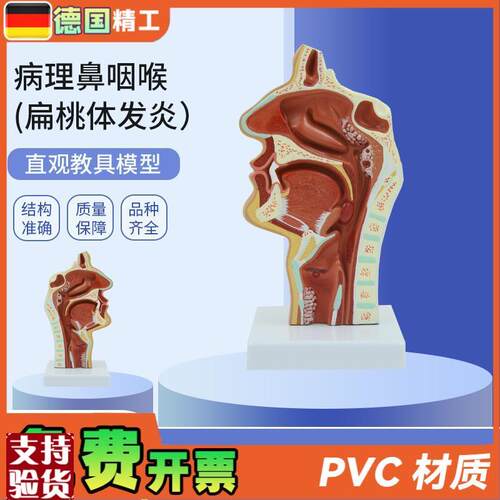 德国】PNT-073n6人体鼻腔咽喉解剖教学模型病理鼻咽喉(扁桃体发