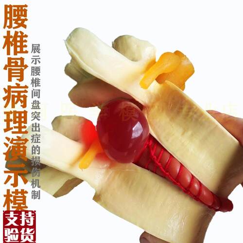 正品腰椎模型人体腰椎间盘演示教具H脊柱模型脊椎模型关节模型