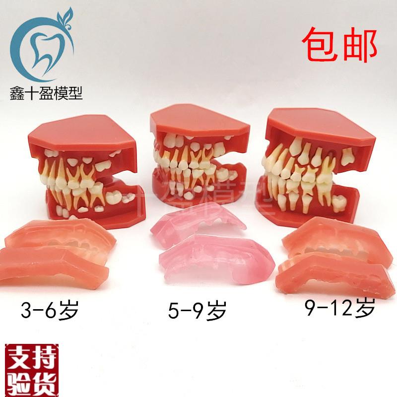 儿童乳牙替换牙齿模型乳r恒牙交替3个阶段口腔5-9髓牙列发育模型