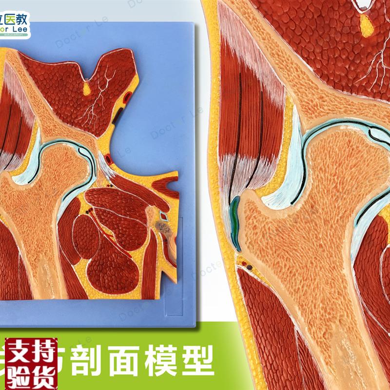 人体断层扫描髋关节s切面浮雕髋关节断层解剖学模型ct