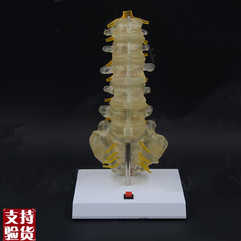 腰椎模型灯光控制人体脊r柱结构椎间盘突出压迫神经骨科病理示教