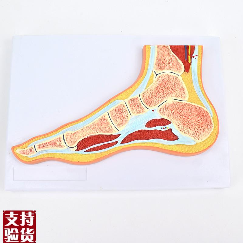 ENOVO颐诺医学解剖足关节骨骼肌肉模型踝K关节剖面脚关节构造MRI