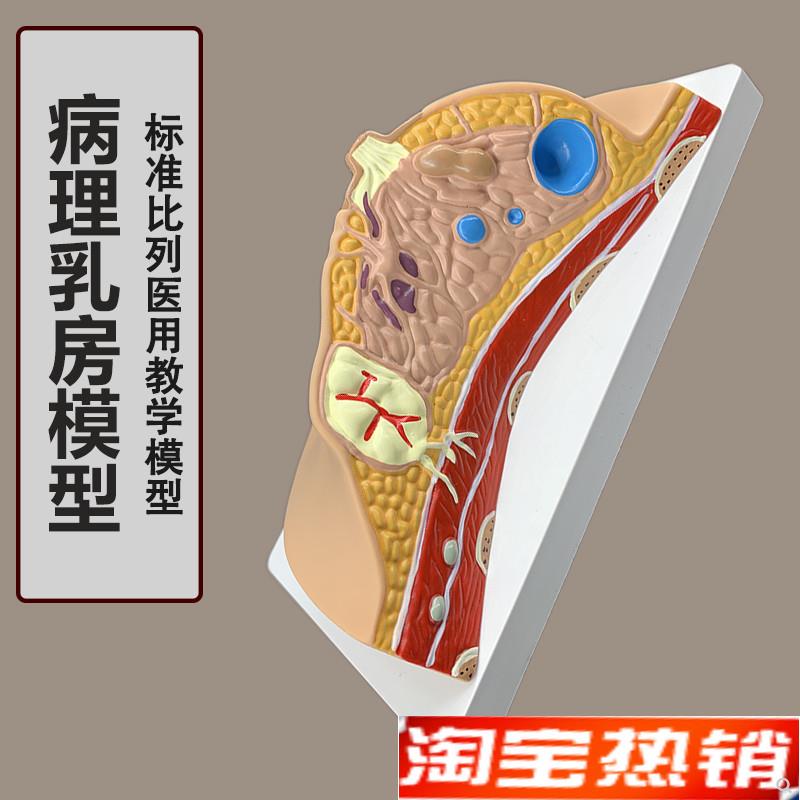 女性病理乳房模型人体1:1x乳房模型乳腺解剖女性医院教学教具