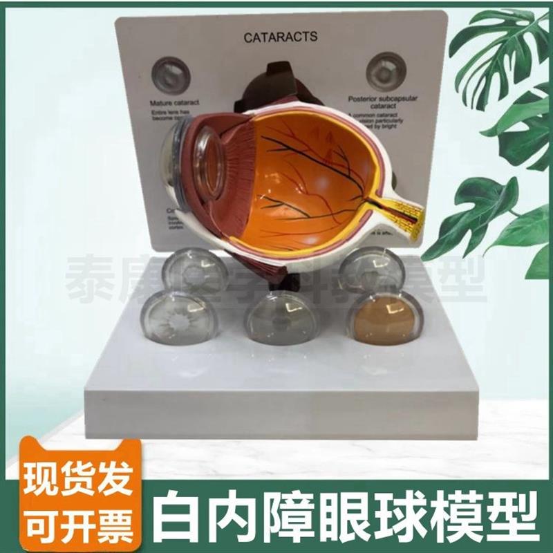 白内障眼睛模型可拆卸眼科医生用晶状I体病变眼底视网膜神经血管