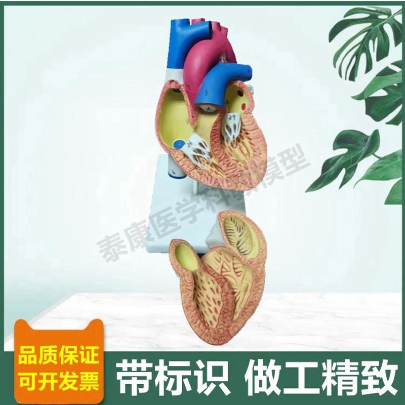 人体心脏模型可拆k卸冠状动脉血管心脏B超彩超教学临床循环三尖瓣