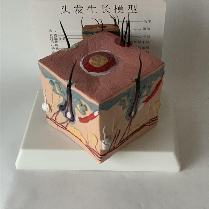 人体头发生长过程教o学模型毛囊堵塞毛孔粗大毛细血管毛发神经血