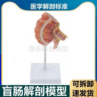 盲肠解剖模型阑尾肠系膜淋巴血管结E肠空肠回肠人体肠道病理医患