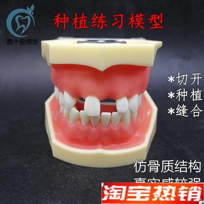 牙科种植上下缺失练习切开种植缝合仿骨质牙齿模V型上颌窦提升术