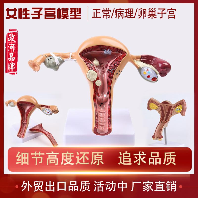 人体模型女性生殖病理子宫阴道卵巢医用教学模具病理变Y化培训器