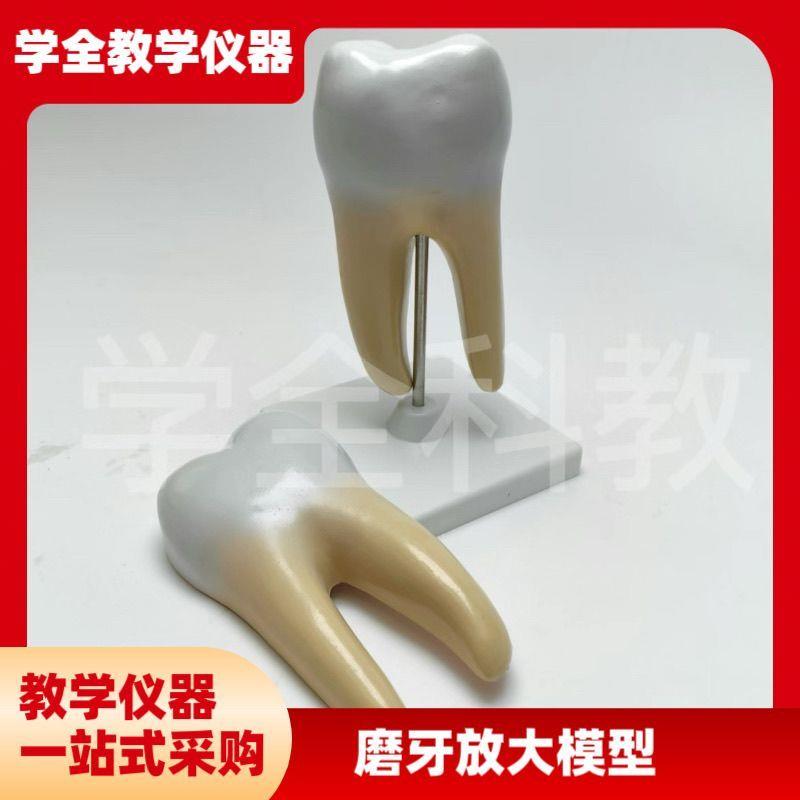 磨牙放大模型蛀牙牙齿t结构口腔牙医学牙科医患沟通尖牙切牙