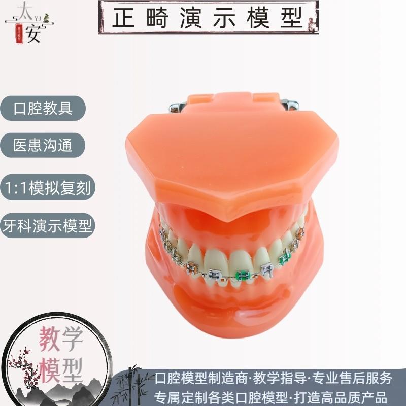 正畸错位牙齿e模型牙齿矫正模型厂家直供口腔教学模型牙齿托槽矫