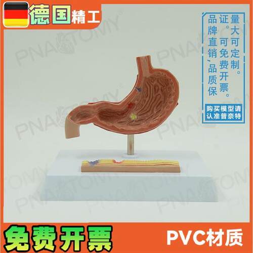 仿真人体胃解剖病理胃胃穿教H学消化系统消化科标本